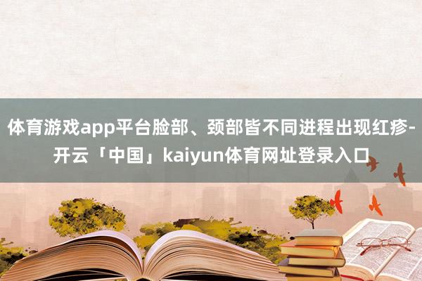 体育游戏app平台脸部、颈部皆不同进程出现红疹-开云「中国」kaiyun体育网址登录入口